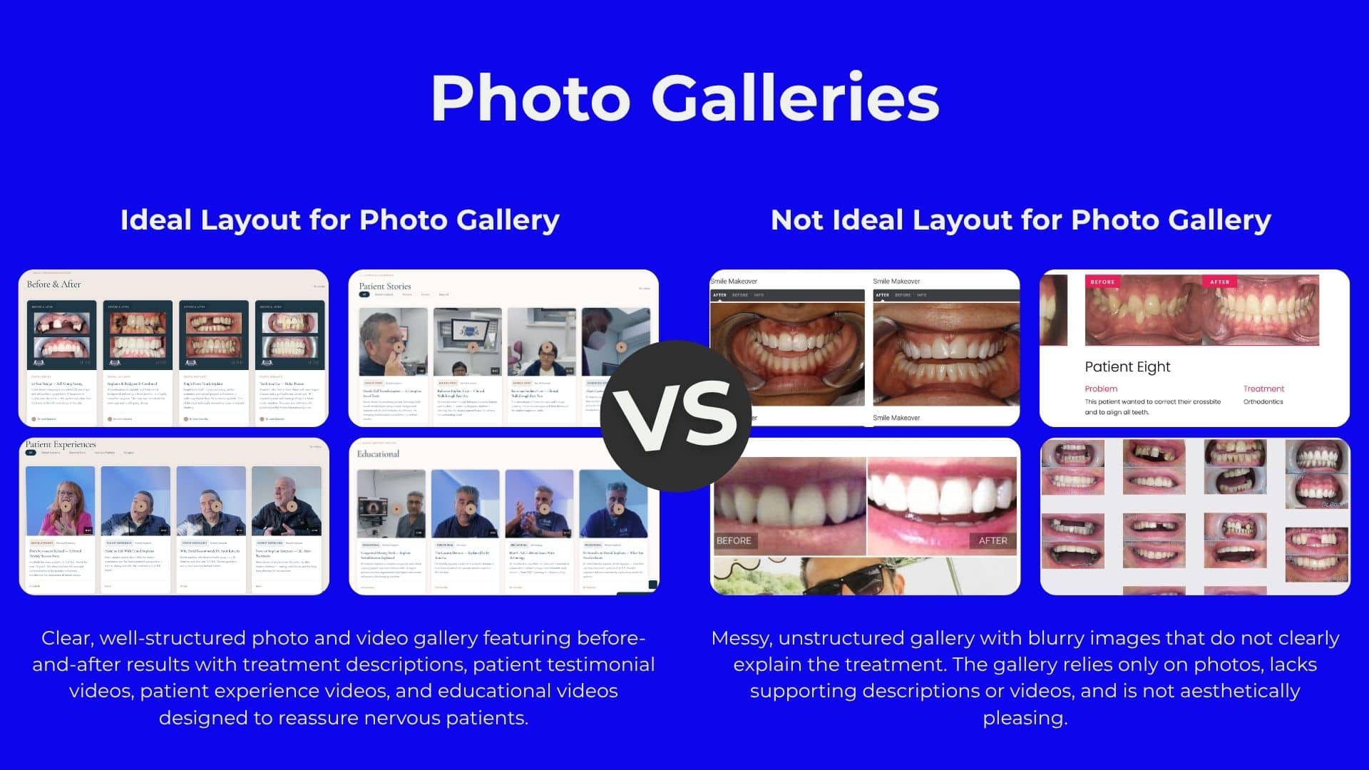 Dental content day imagery for before and after galleries and patient video content